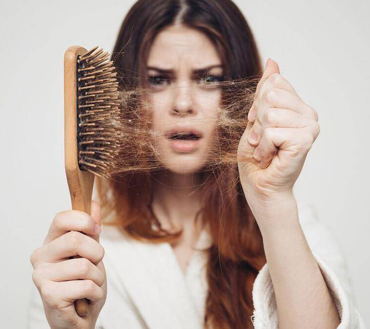 PCOS and Hair Loss